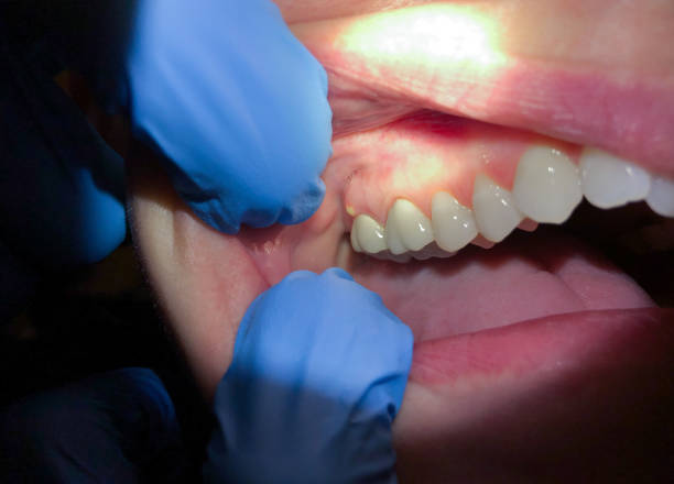 Best Urgent Dental Care for Toothache in Withamsville, OH