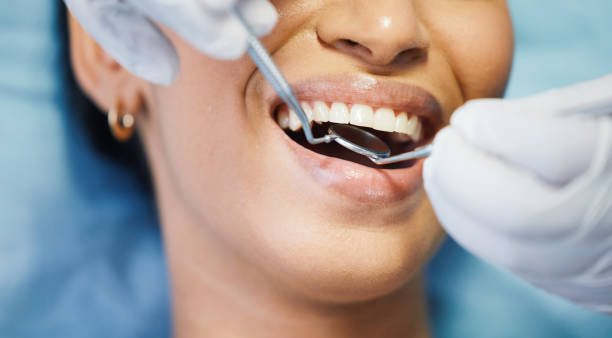 Best Broken or Cracked Tooth Emergency Dentist in Withamsville, OH