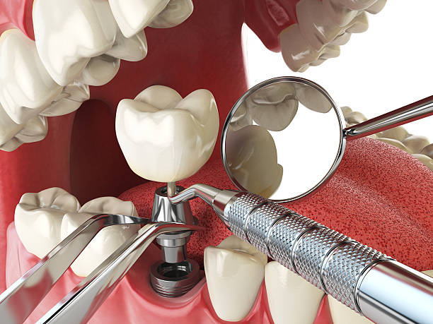 Best Emergency Dental Care for Abscessed Tooth in Withamsville, OH